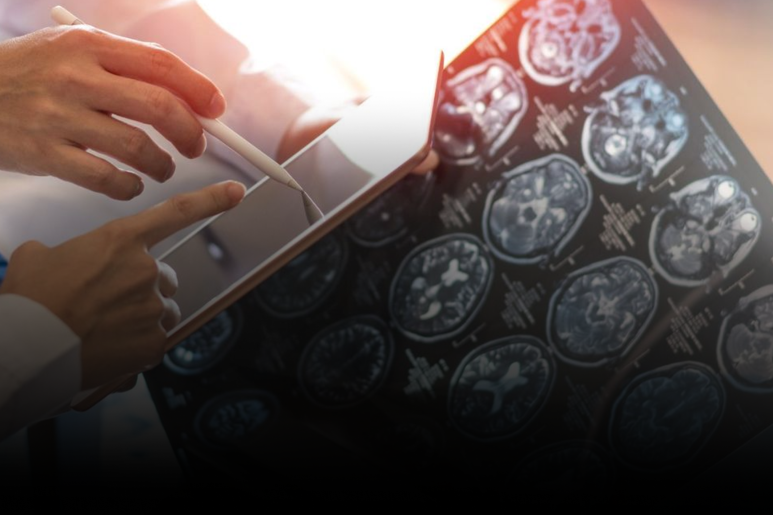 IA agiliza decisões clínicas em oncologia no Brasil